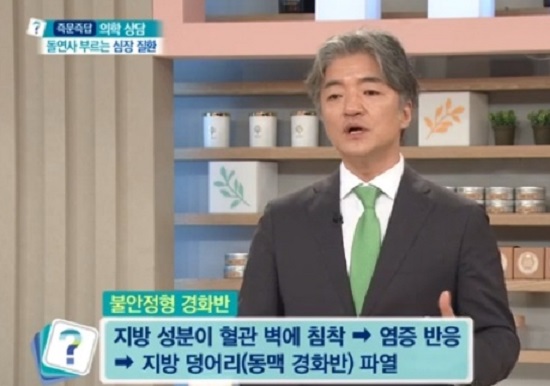 EBS명의-심혈관명의-김병극-교수