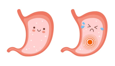 위암 증상 잦은 방귀