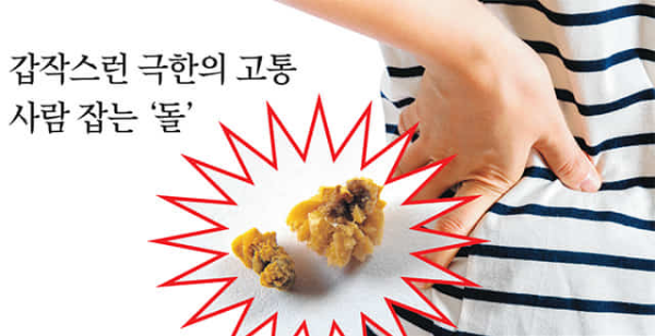 요로 결석