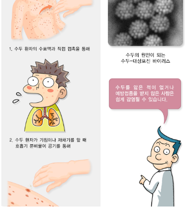 대상포진 전염되나