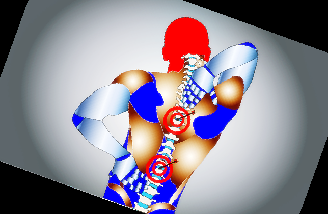 허리 삐끗했을때 찜질 방법