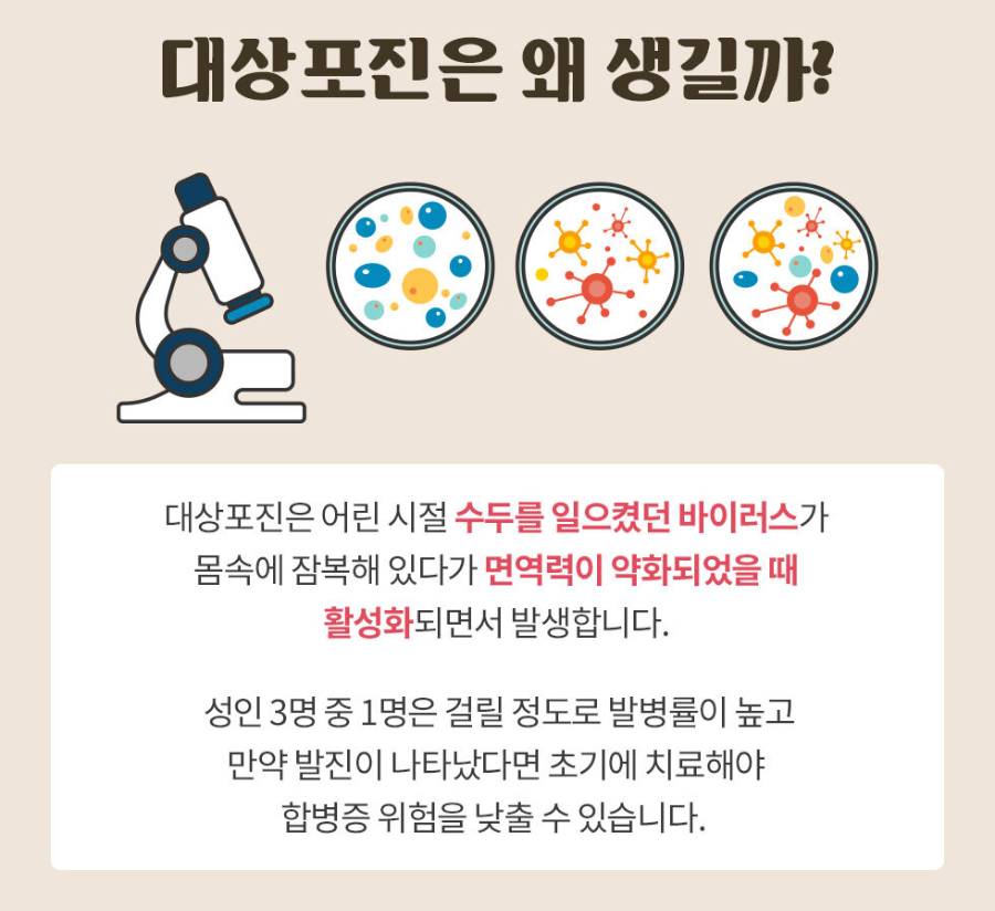 대상포진 원인