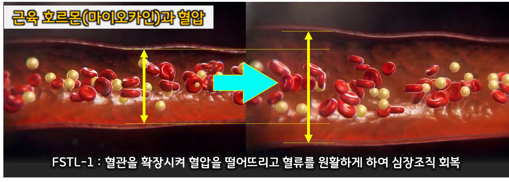 근육 호르몬 (마이오카인, 혈압 개선, 지방간 케어)