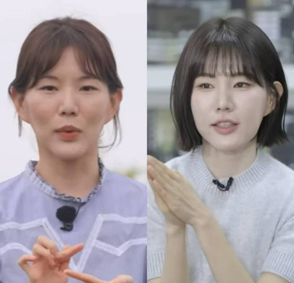 나는 솔로 29기 현숙 보톡스&amp;#44; 필러