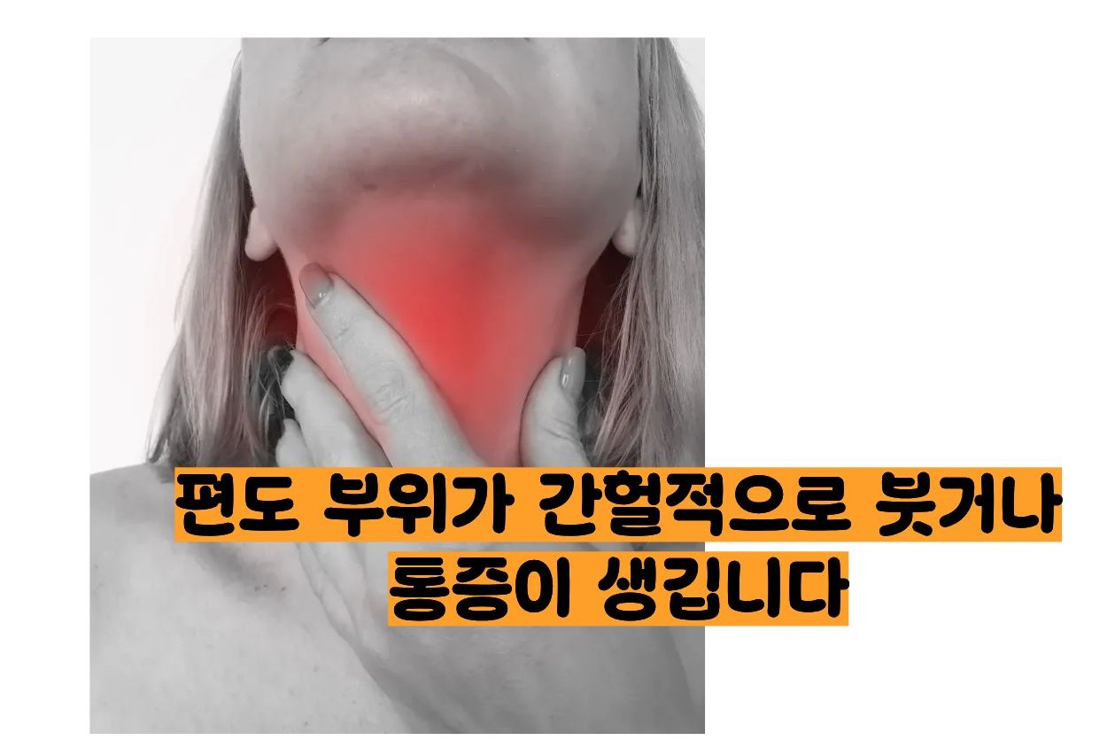 편도결석 증상