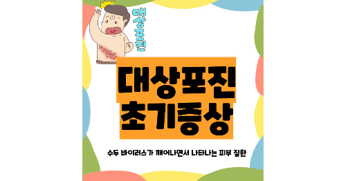 대상포진 초기증상