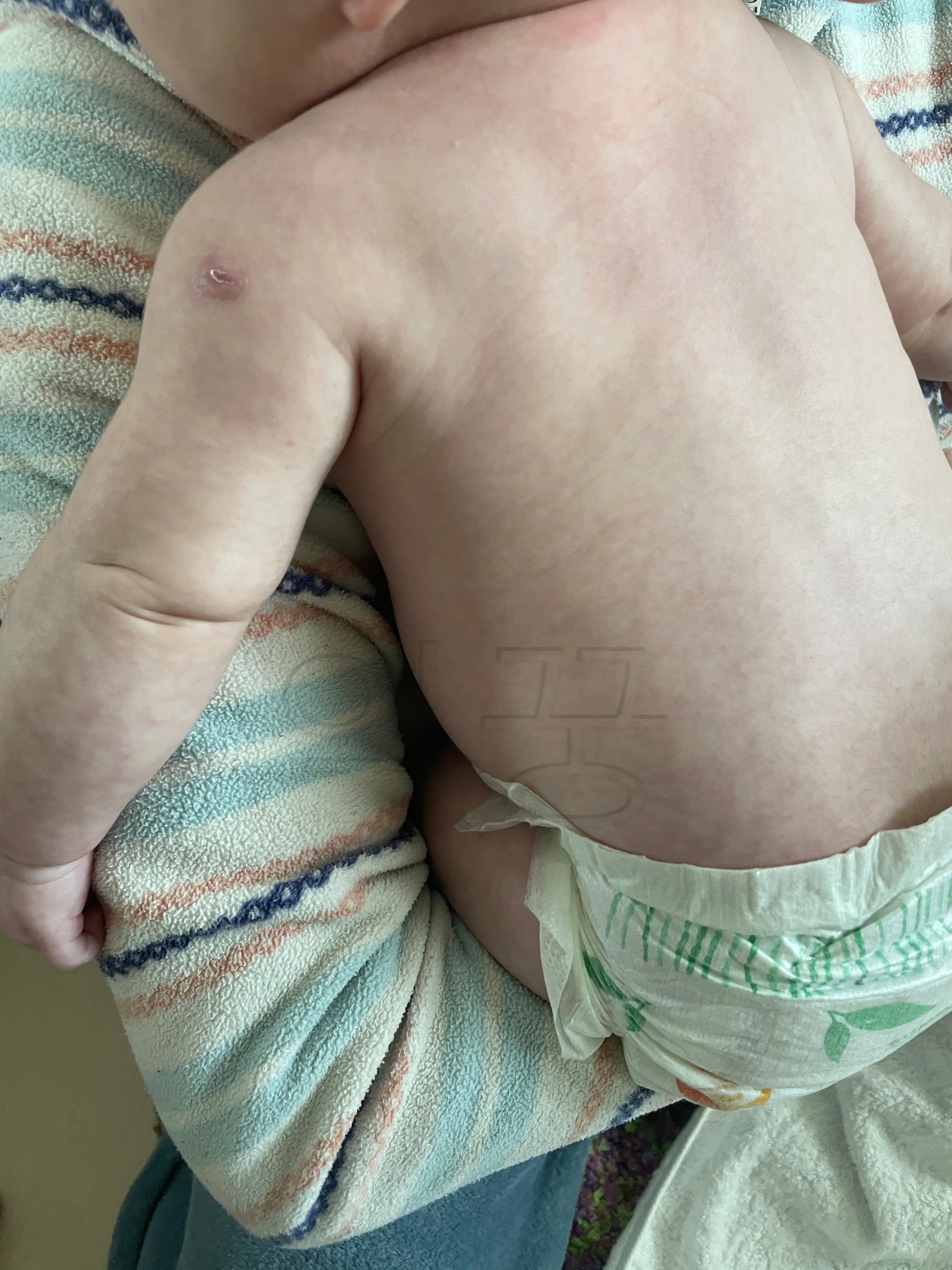 아기 코로나 증상 열 내리는 방법 38도 이상 올라갈 때 이렇게 하자5