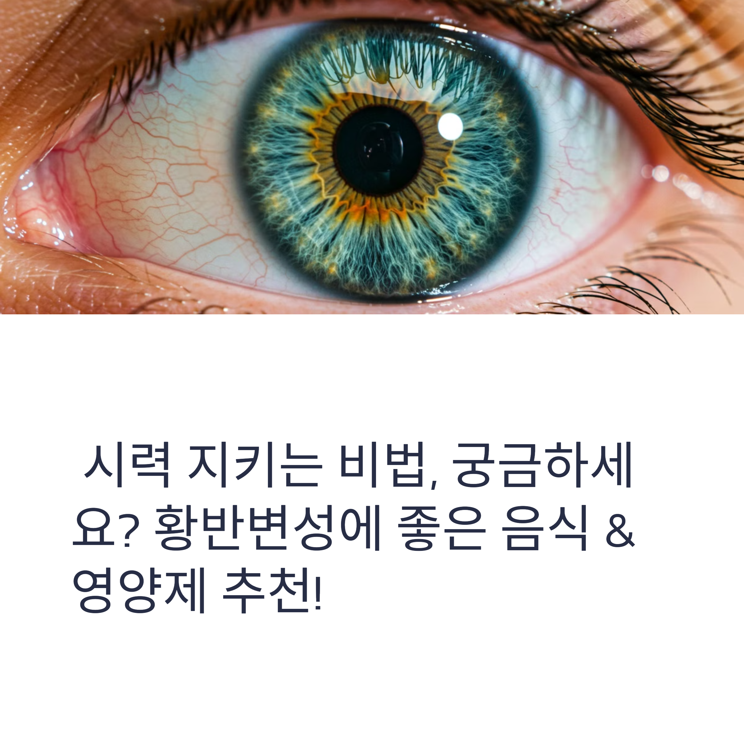 황반변성에 좋은 음식과 영양제 추천