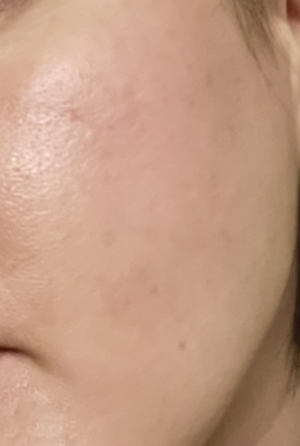 엑소프록실 시카 엑소좀 미네랄 워터 토너패드