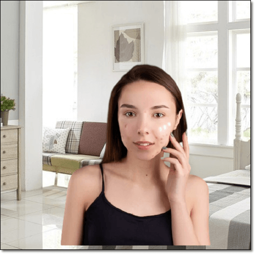 피부 염증이 있는 여성