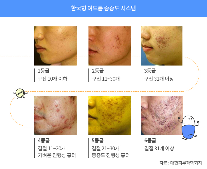 피부 트러블 사진