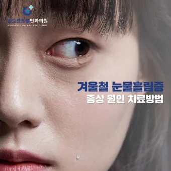 눈물이 자주 나는 이유에 대한 안과정보_14