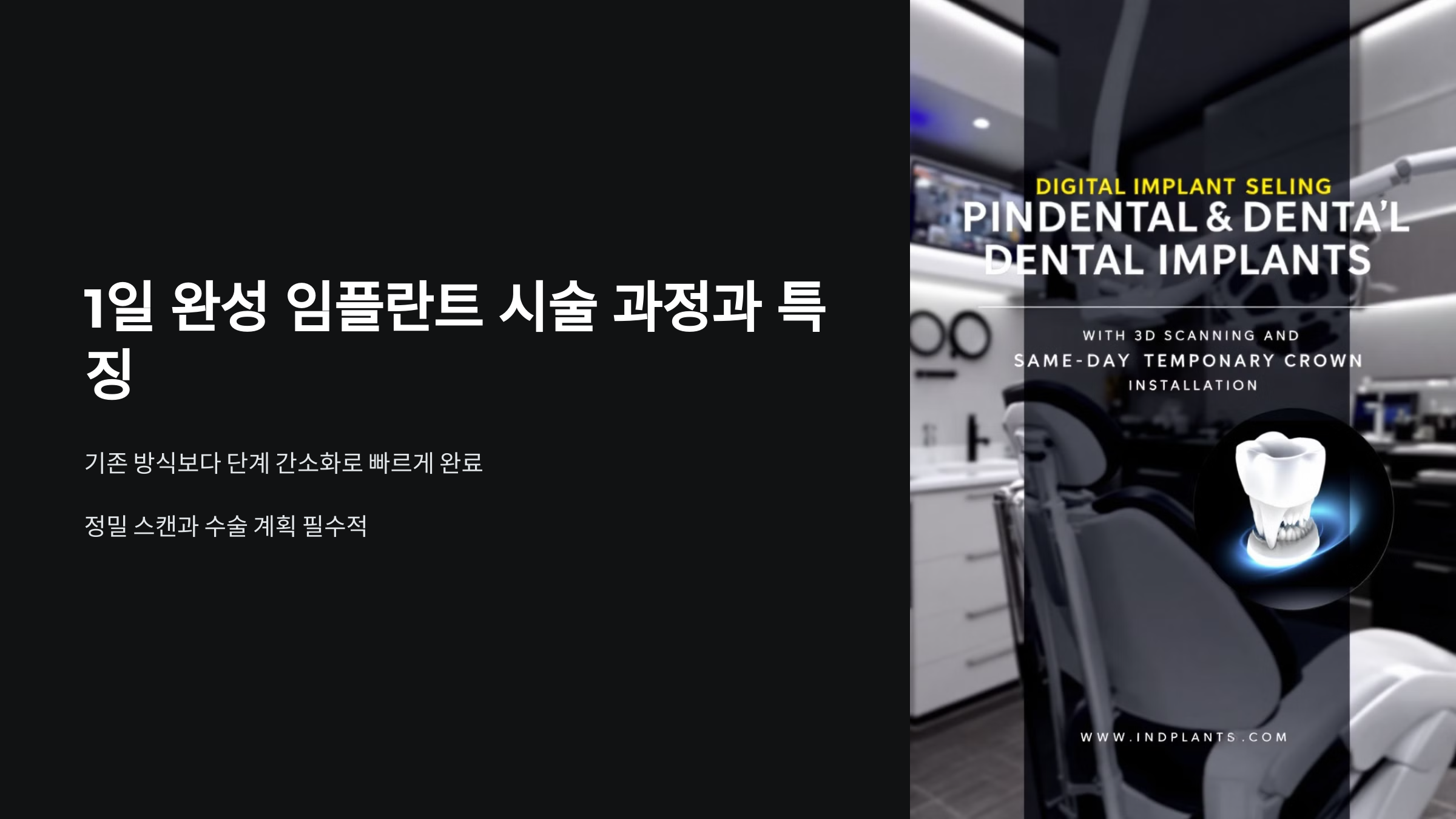 1일 완성 임플란트란?