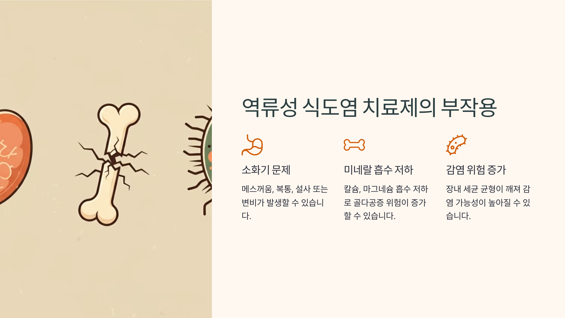 역류성 식도염
