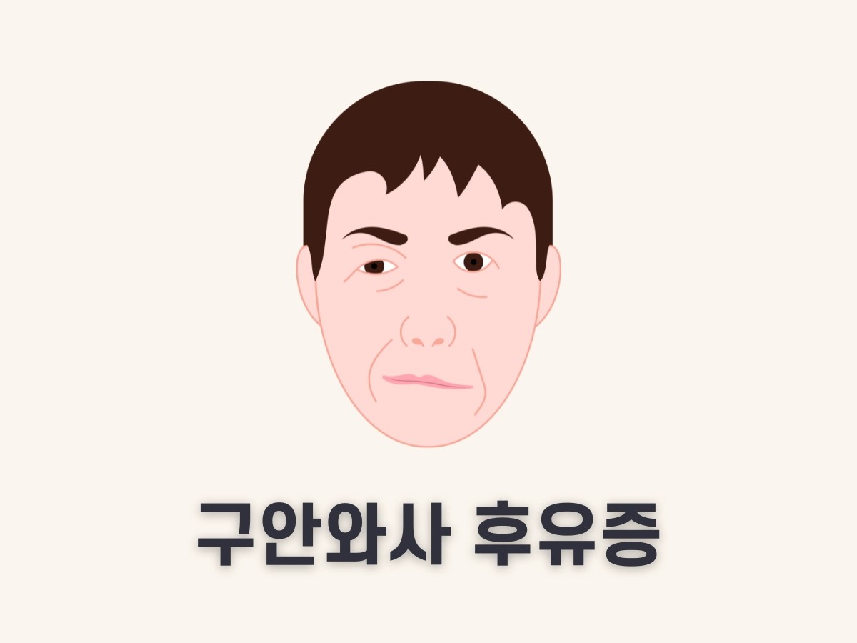 구안와사 후유증
