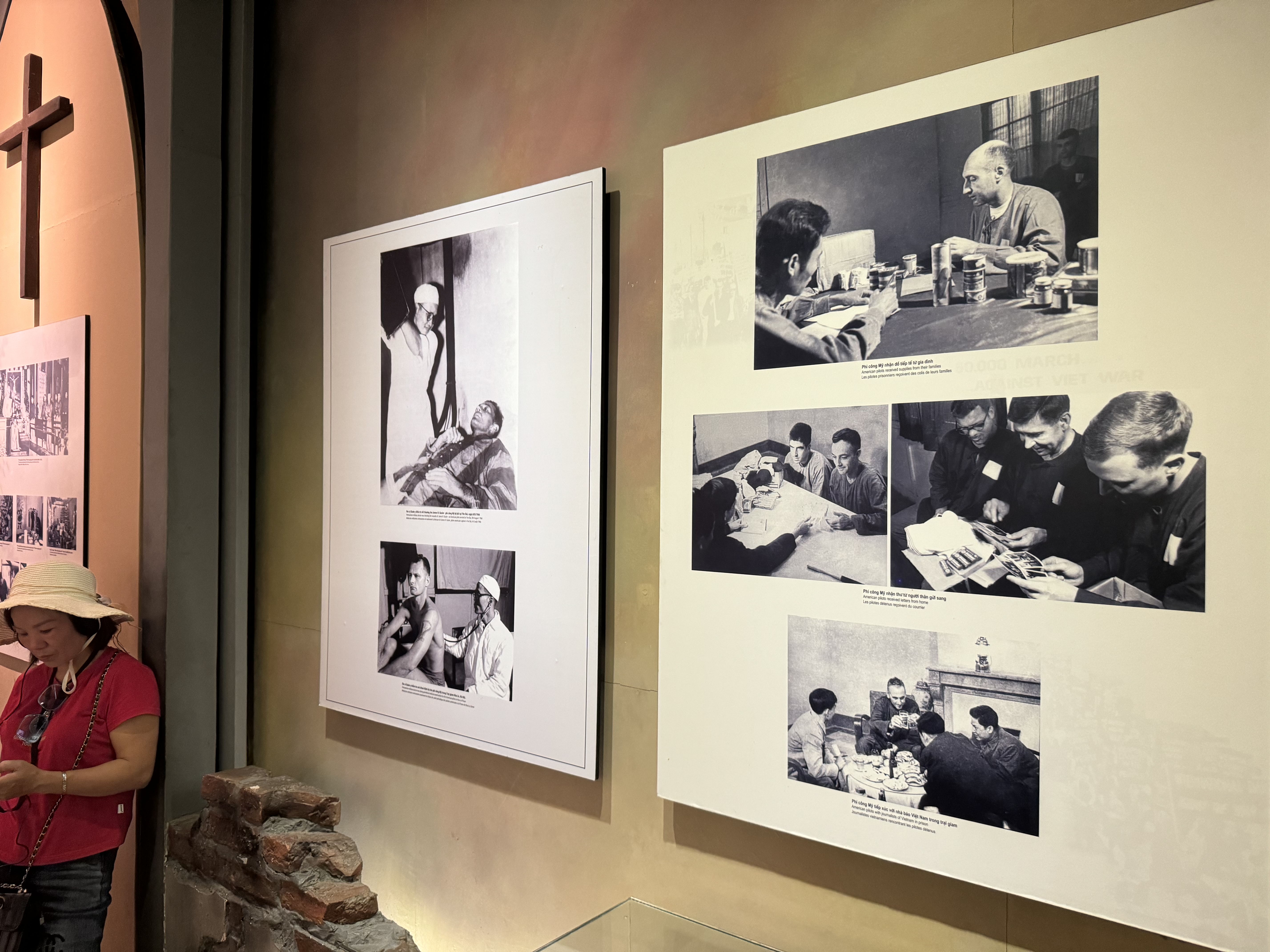 고엽제 피해 사진