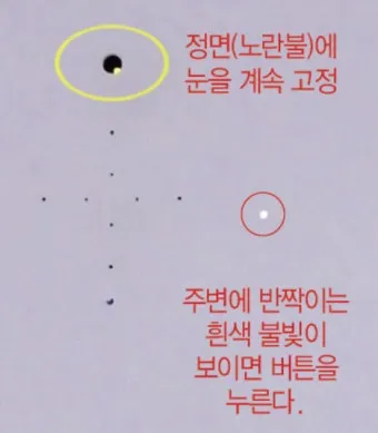 녹내장 진단 검사 비용 안압 검사주기 관리법_18