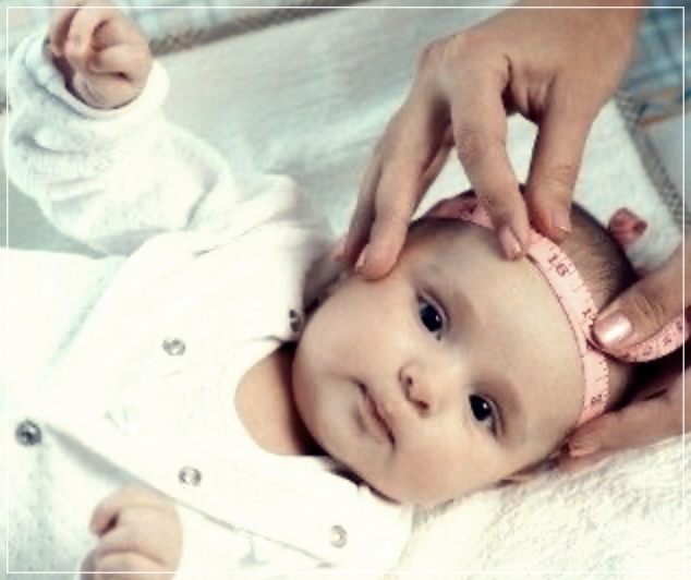 소두증 이란? 원인, 증상, 치료방법들