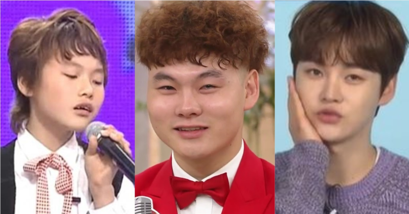 박서진 성형 변천사