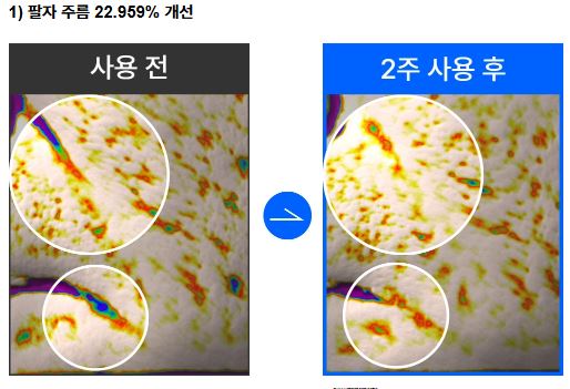 호주 주름크림 효과