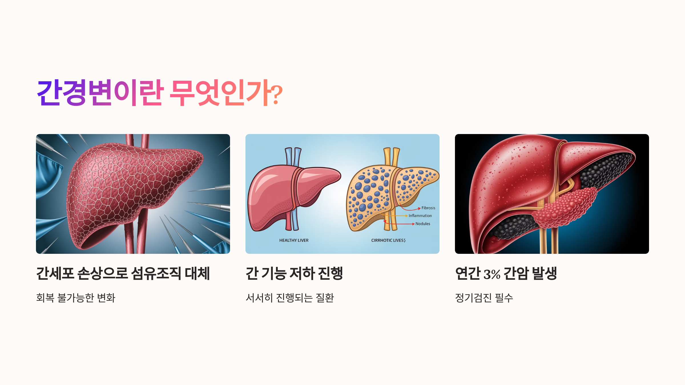 간경변이란 무엇인가?
