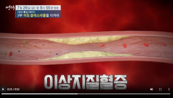 명의 이상열 교수 이상지질혈증