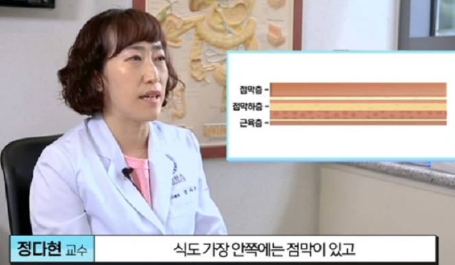 EBS명의-식도암-박종재-교수