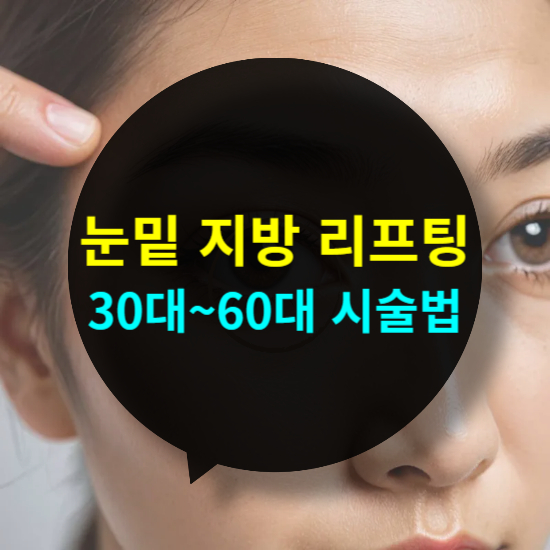 눈밑 지방 리프팅, 30대&middot;40대&middot;50대&middot;60대별 맞춤 시술법 TOP 4