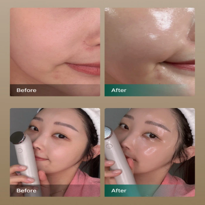 톰 더글로우 내돈내산 후기 가격 효과 부작용 사용 방법