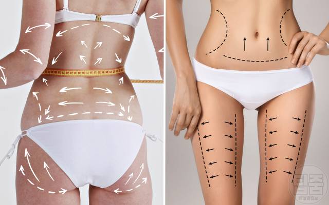 몸선 예뻐지는 운동 매일하면 좋은 운동