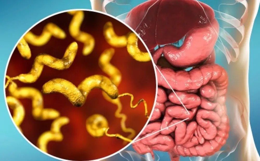 장염의 주원인은 바이러스