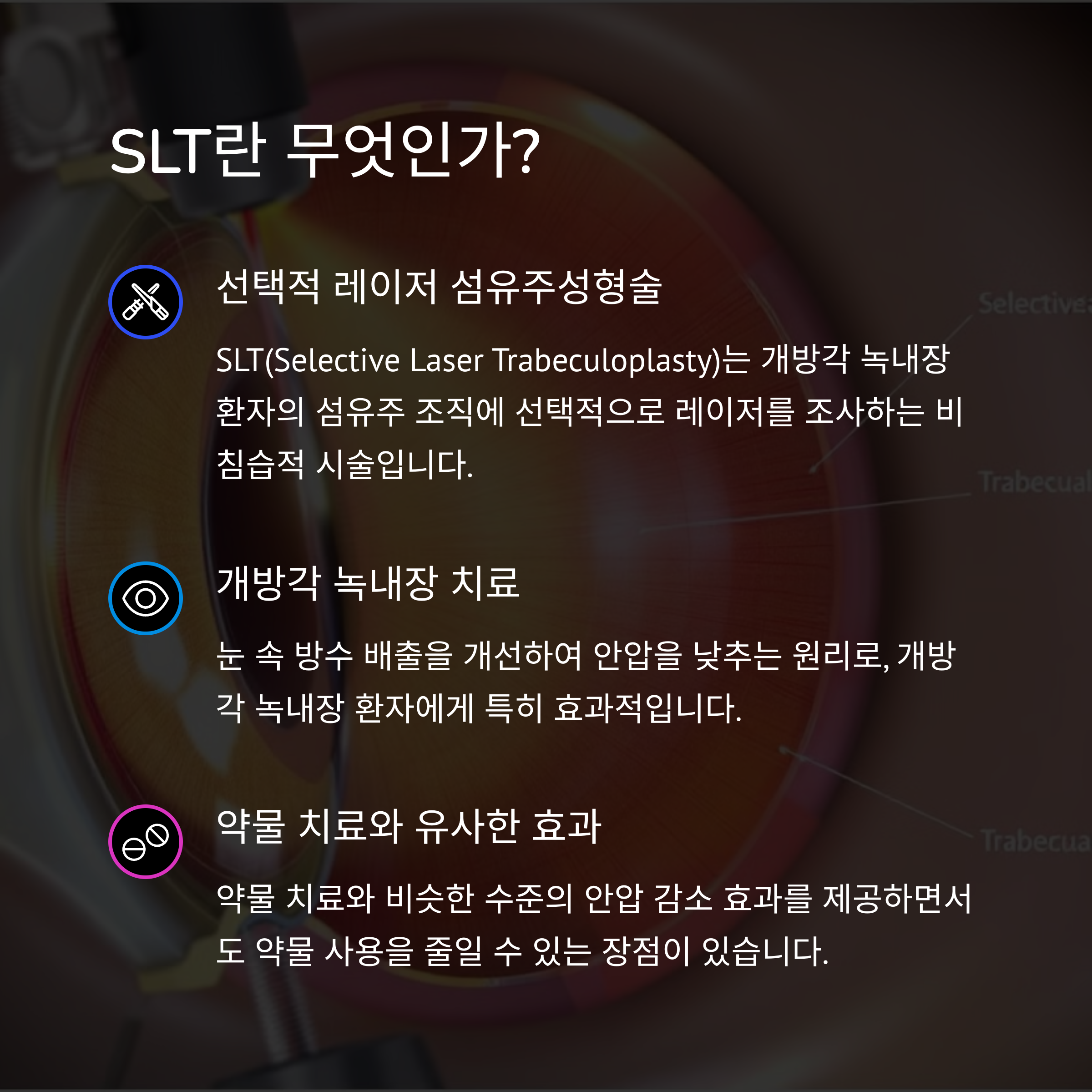 녹내장 레이저수술 전 알아야 할 3가지