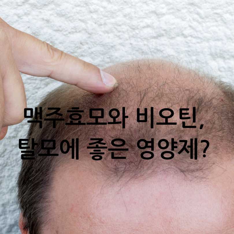 맥주효모와 비오틴, 탈모에 좋은 영양제