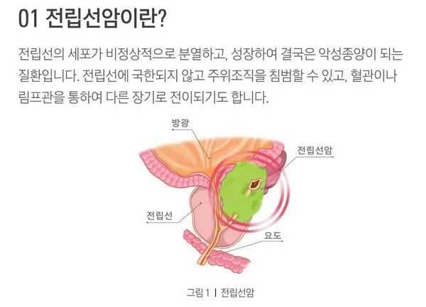 전립선암 초기증상