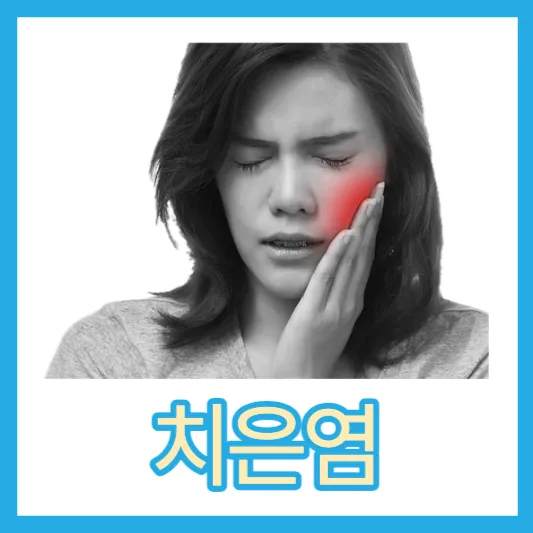 치은염 원인 증상
