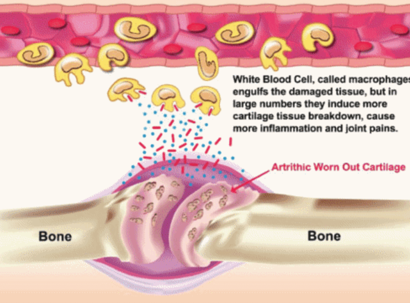 라이토플렉스-효과