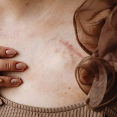 안전벨트 타박상 없애기