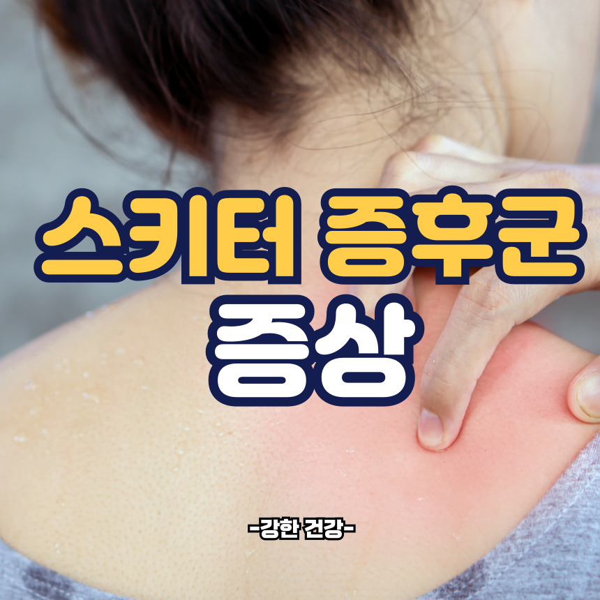 스키터 증후군 증상