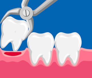 회복을 돕는 영양소와 습관