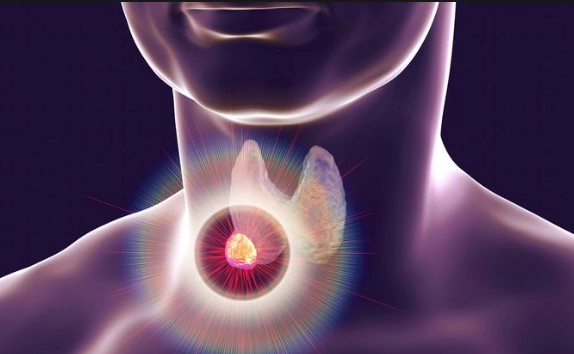 갑상선 미분화암 증상 6가지 및 오윤아 친언니 미분화암 투병 고백