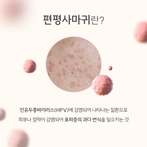 구월동 서울수피부과 피부과전문의