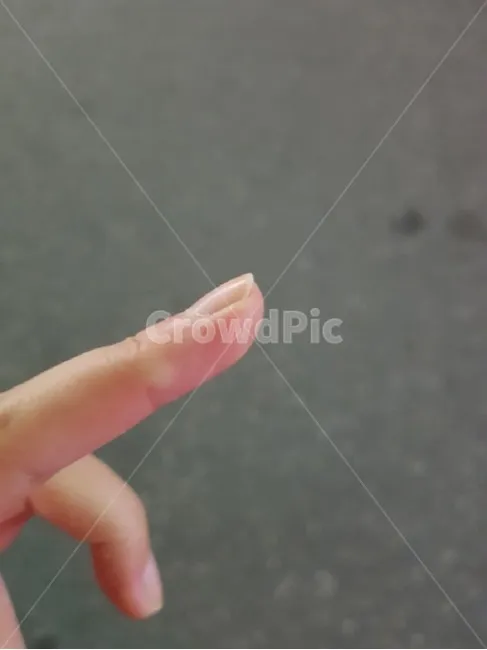 모기 물려 가려울 때 땀띠에 안티푸라민 연고 효능 부작용 사용후기_8