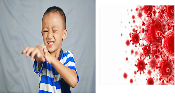 홍역의 증상 및 격리기간