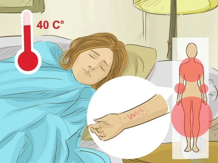 뎅기열 예방접종 증상 전염경로 치료방법 위험국가