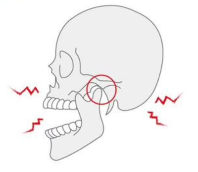 관절 원판 위치