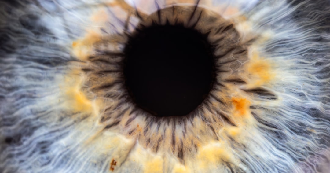 Cataract
