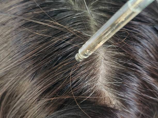 비듬 관리 제품 추천