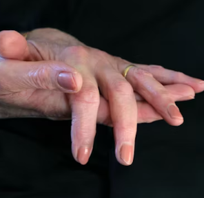 콘드로이친 효능 복용법 시간 부작용