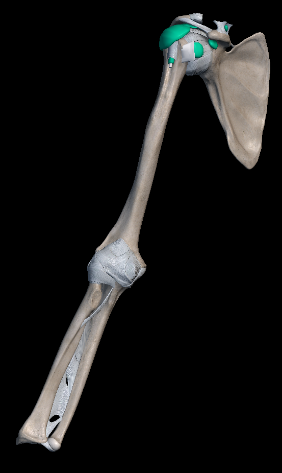 손목 바깥쪽 통증 대표적인 원인