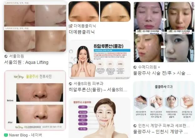 물광주사